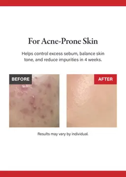 Medicube Red Succinic Acid Peeling Pad