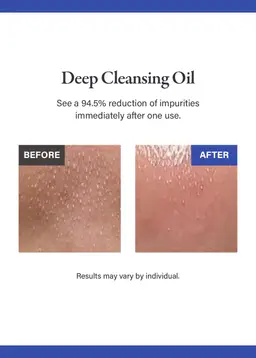 Medicube Zero Pore Blackhead Deep Cleansing Oil 205ml
