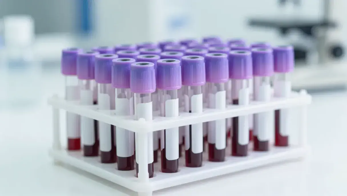 AMH Test in Pakistan: What Your Result Means and What You Can Do About It