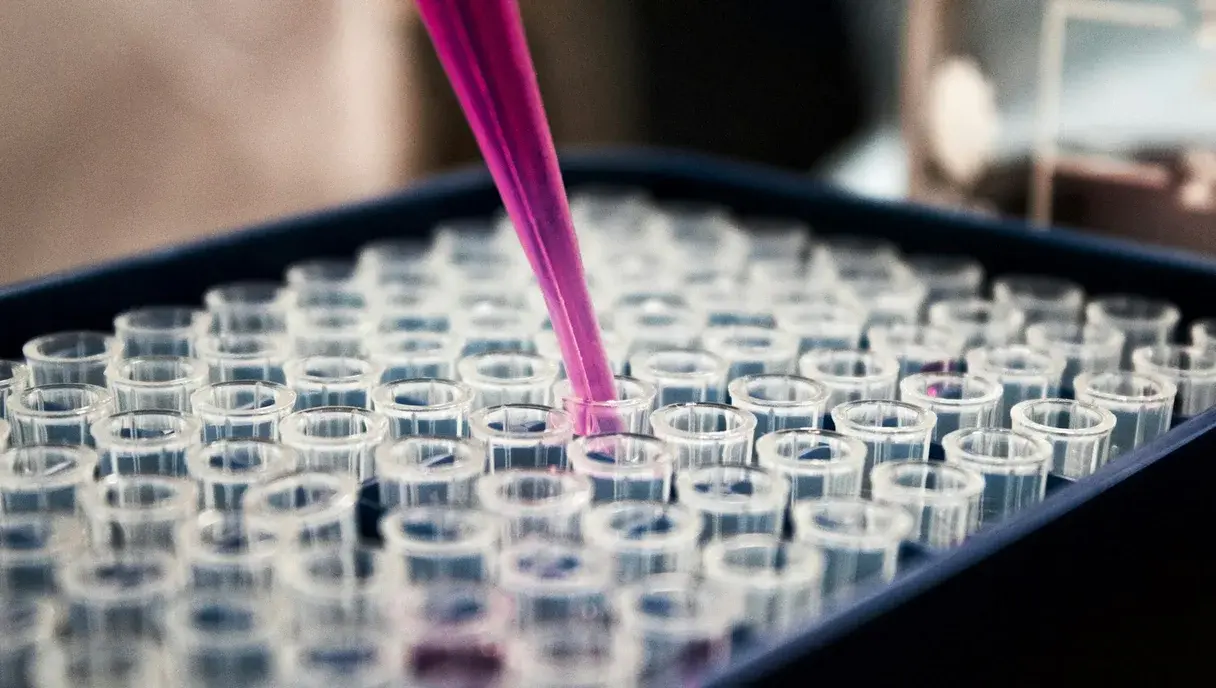Semen Analysis (HSA Test): Price in Pakistan and How to Read Your Report