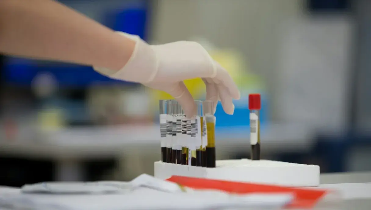 Thyroid Test Price in Pakistan: TSH, T3, T4 and How to Read Your Report