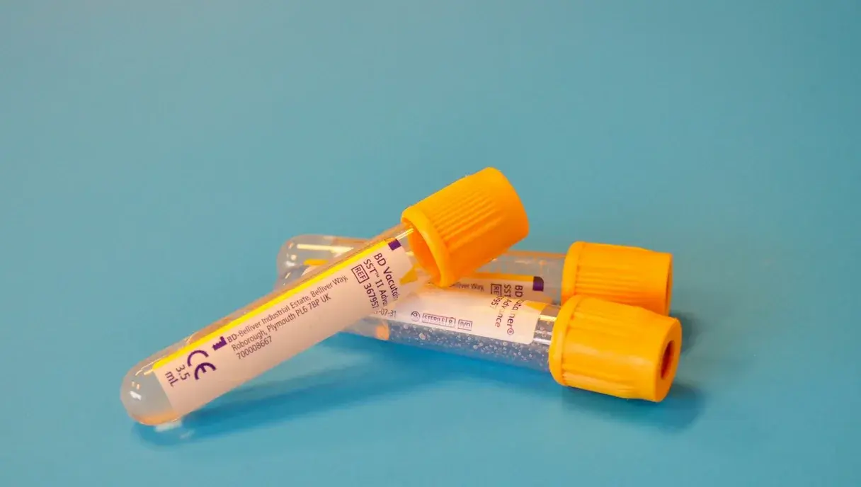 Thyroid Symptoms: What to Watch For & When to See a Doctor (Pakistan 2026)