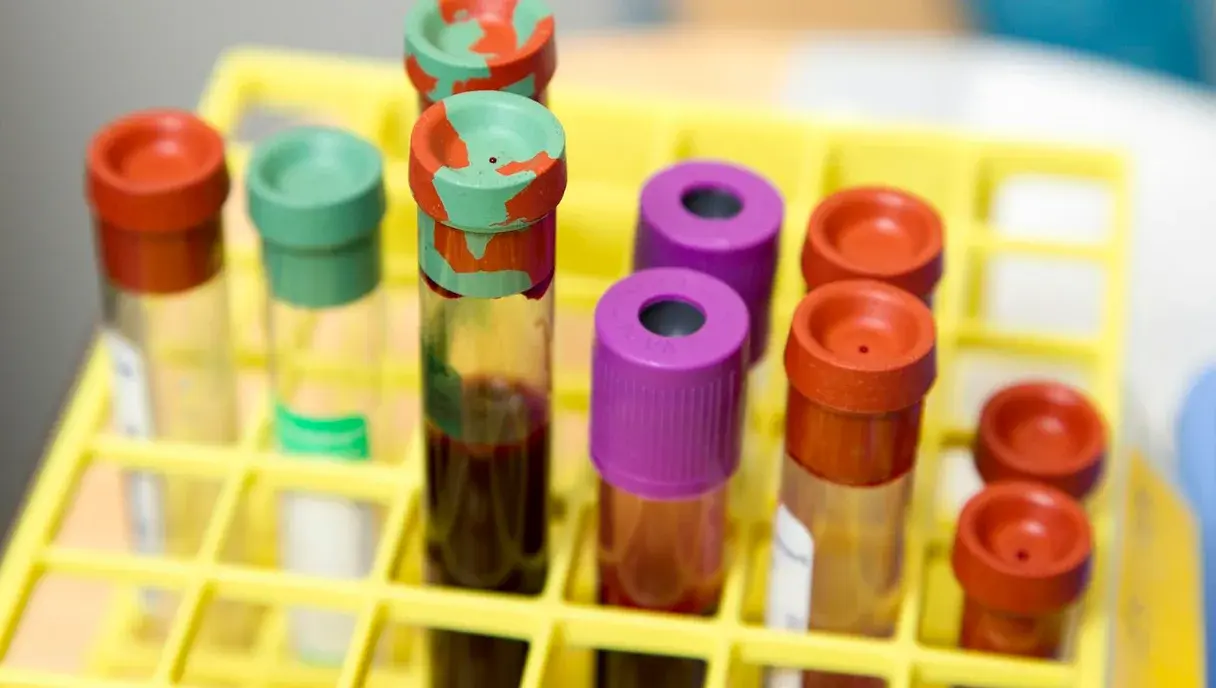 FSH Test: What It Measures and What Your Result Means