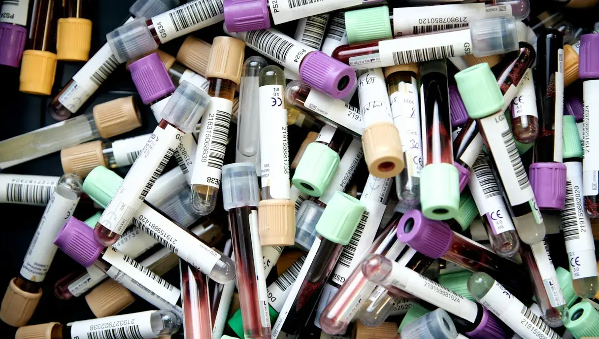 AMH Test in Pakistan: What Your Result Means and What You Can Do About It